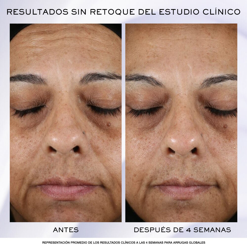 Los resultados antes y después de la crema facial anti-edad muestran una reducción de los signos visibles del envejecimiento después de 4 semanas 