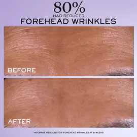Rénergie C.R.x. Triple Serum Retinol