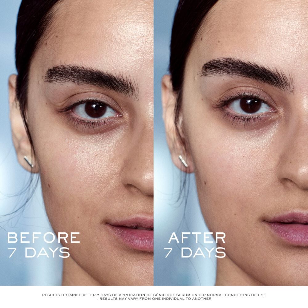 Comparación de antes y después del suero facial Génifique de Lancome en una modelo